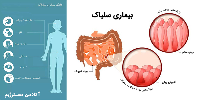 بیماری سیلیاک چیست