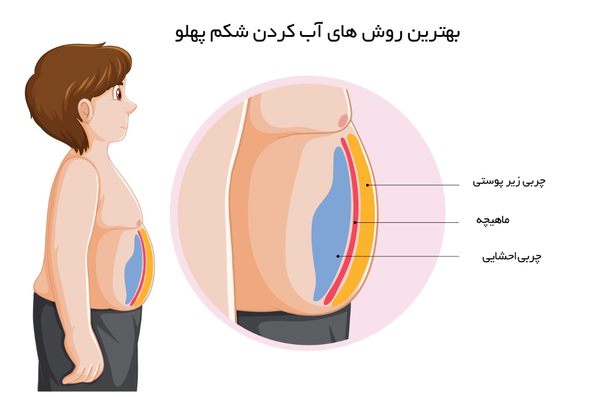  آب کردن شکم پهلو