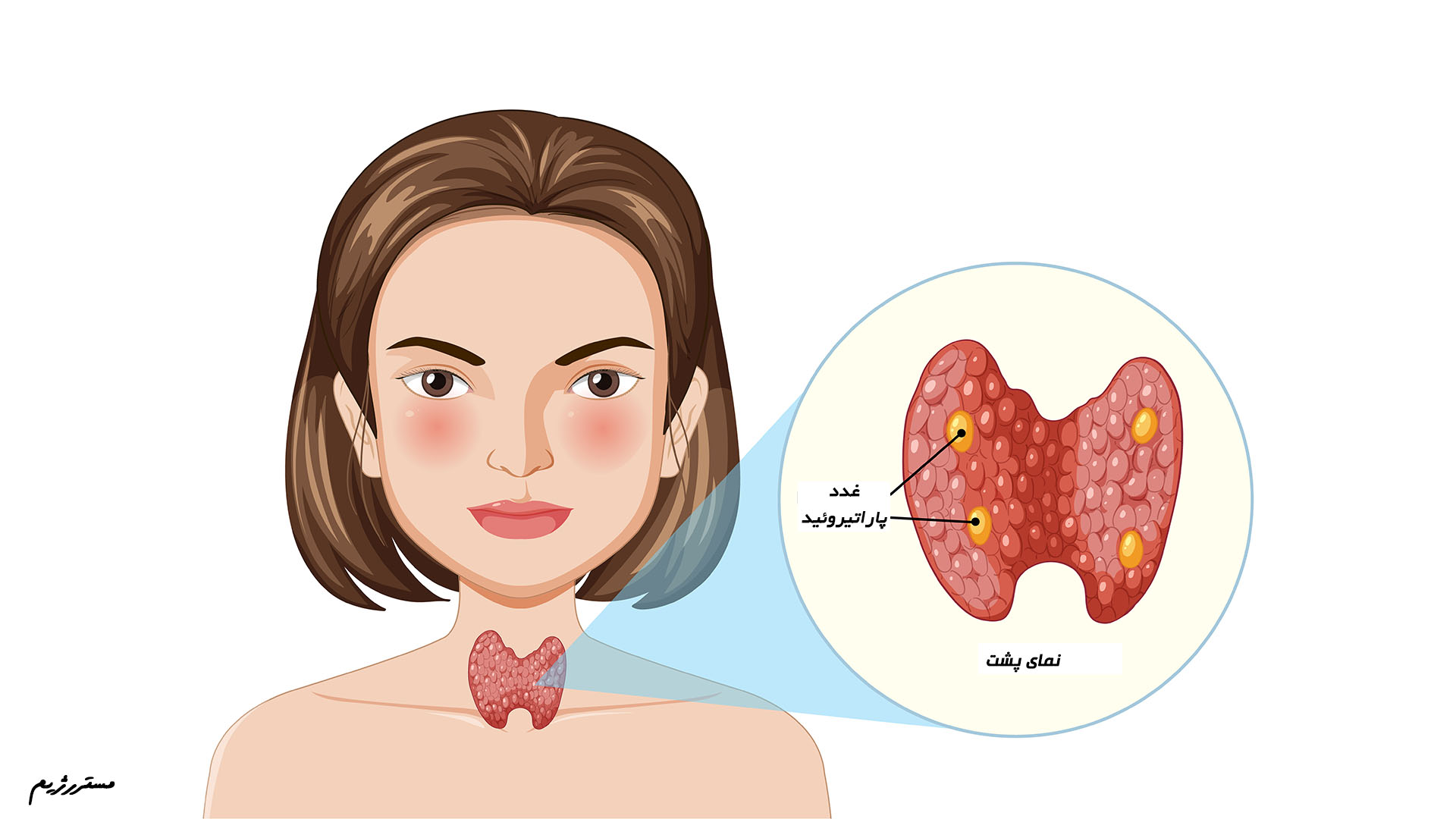 نمای پشت غدد پاراتیروئید