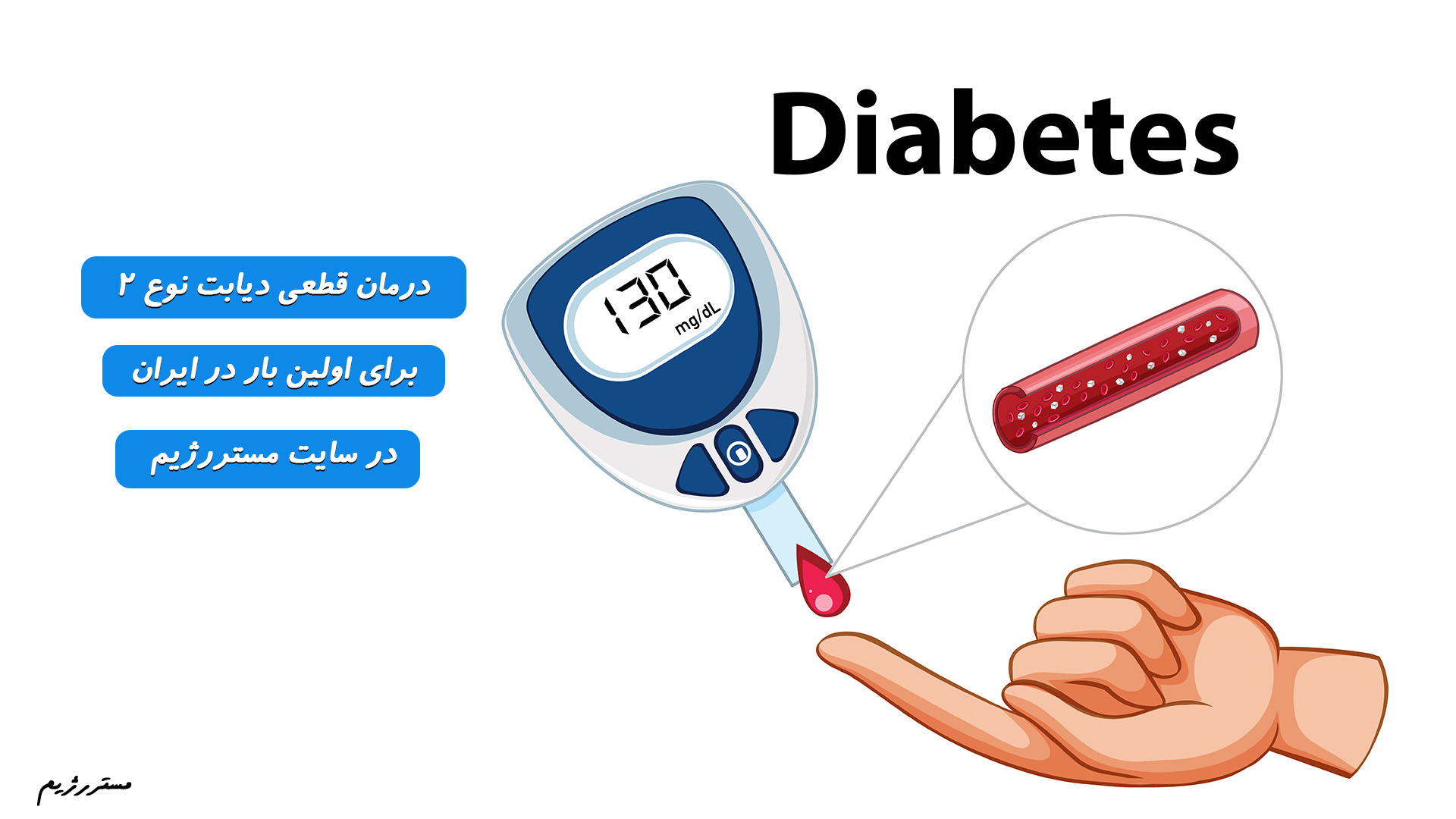 درمان قطعی دیابت نوع دو