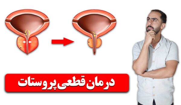 درمان پروستات